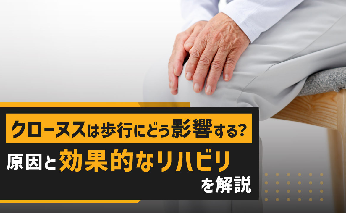 クローヌス と は