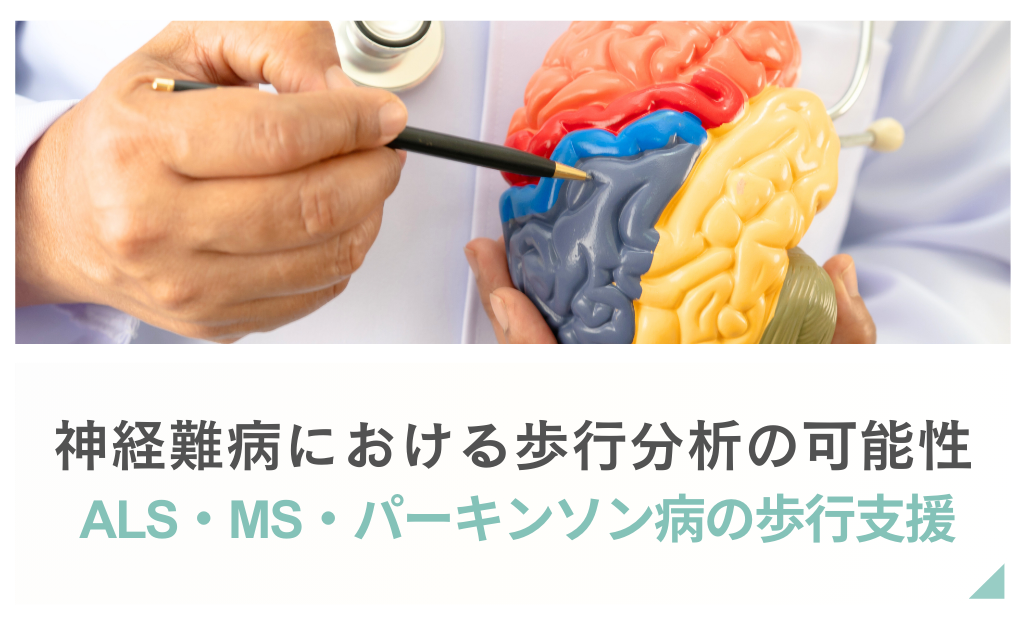 神経難病における歩行分析の可能性 ― ALS・MS・パーキンソン病の歩行支援